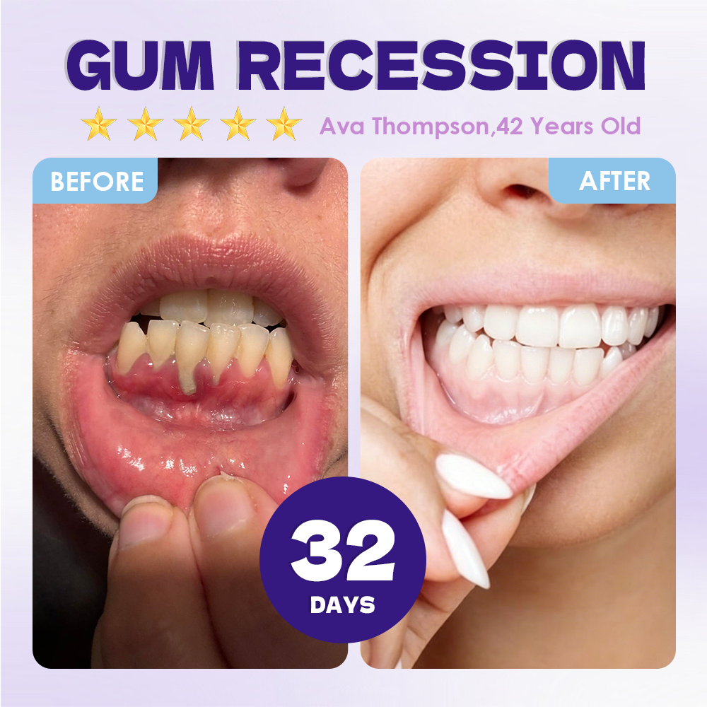 GFOUK® Tideglusib Tooth & Gum Repair Oral Microneedle Patch🦷