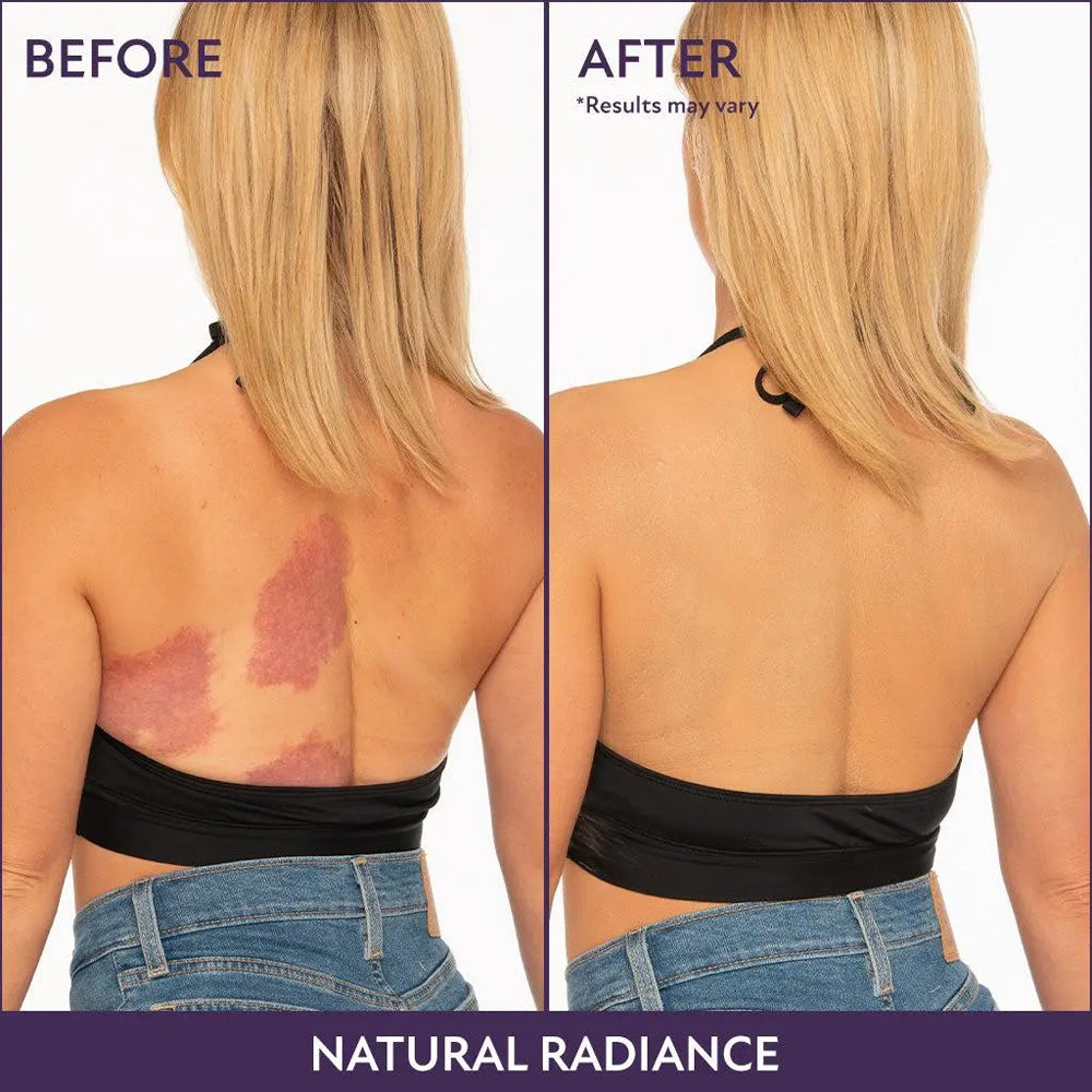 🎁LAST DAY 50% OFF ✨ Rolimey® Body Coverage Perfector