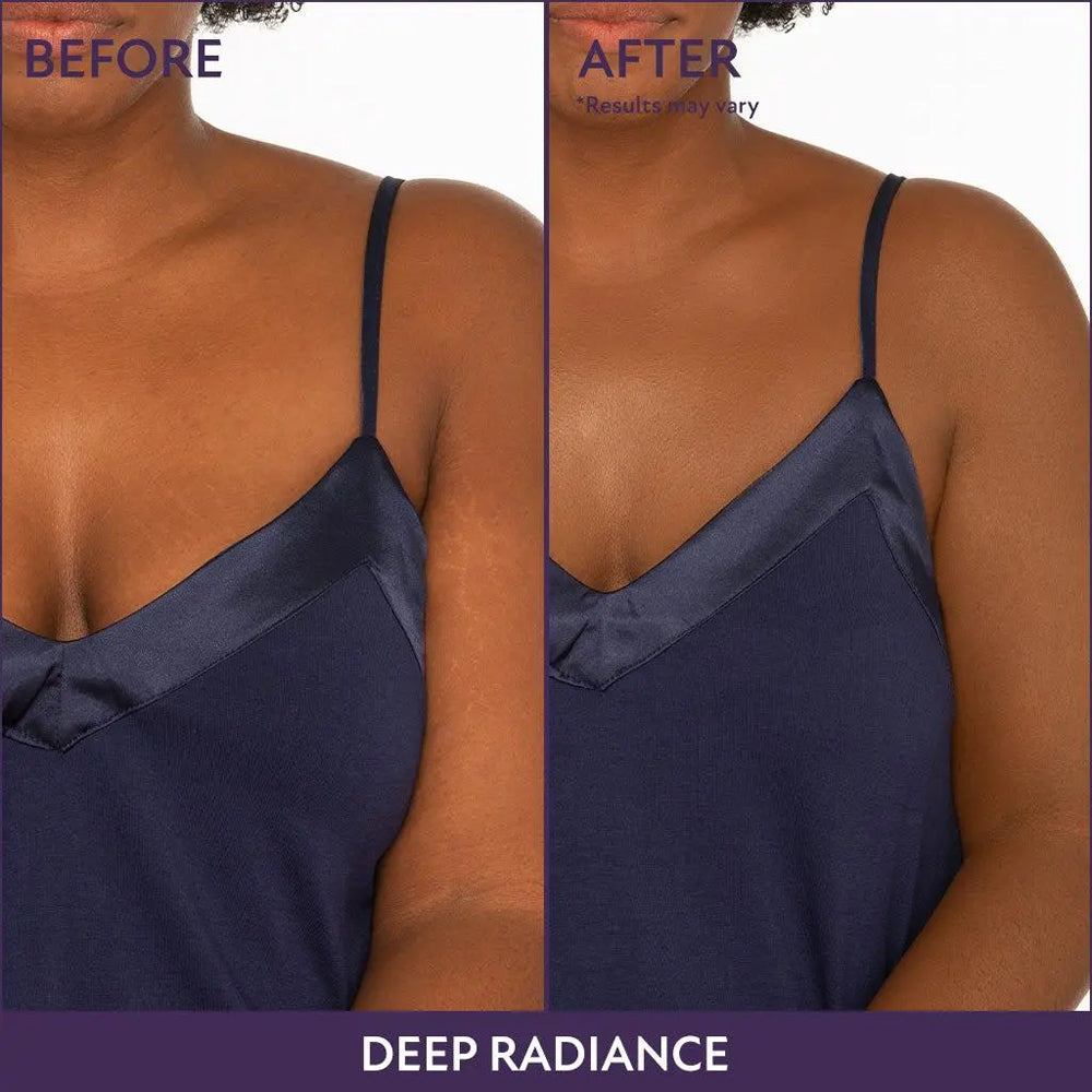 🎁LAST DAY 50% OFF ✨ Rolimey® Body Coverage Perfector
