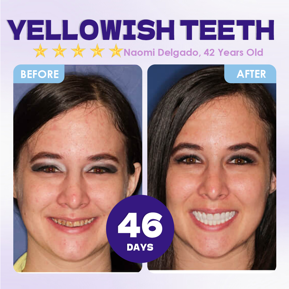GFOUK® Tideglusib Tooth & Gum Repair Oral Microneedle Patch🦷