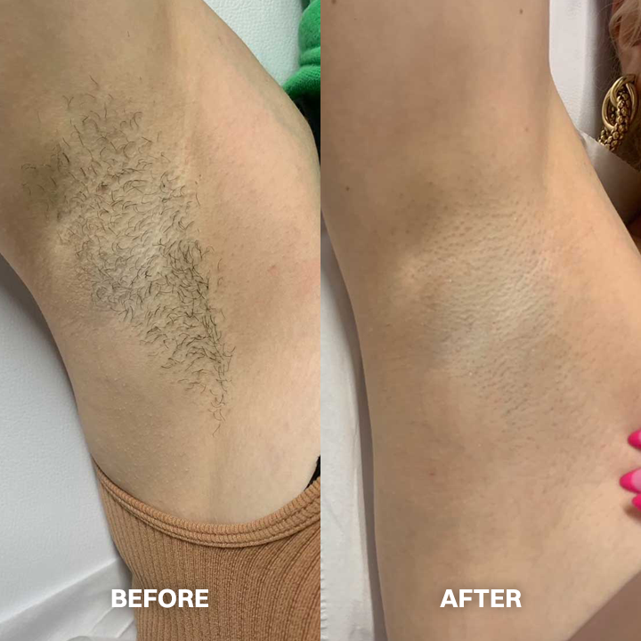Lovyanocosh® Body Hair Removal Cream for All Women & Men