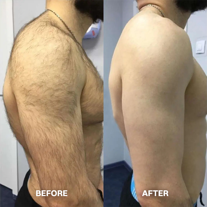 Lovyanocosh® Body Hair Removal Cream for All Women & Men
