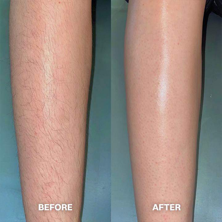 Lovyanocosh® Body Hair Removal Cream for All Women & Men