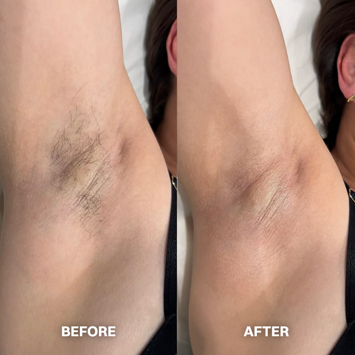 Lovyanocosh® Body Hair Removal Cream for All Women & Men